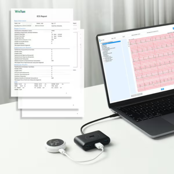 Viatom Lepod Pro ER3 7 elvezetéses 24 órás mini EKG holter monitor - Image 5